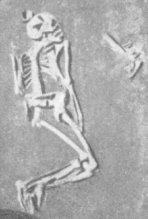 Skelett in halboffener Hockerlage